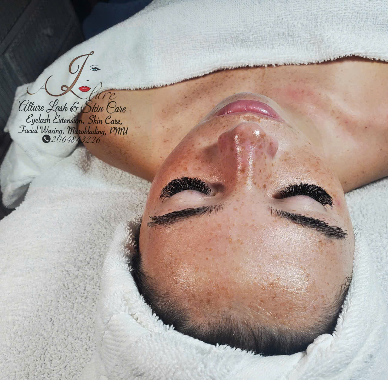 Close-up of a client's face after a hydrating facial